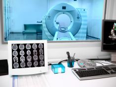 Ve frontě na magnetickou rezonanci vystojíte v Česku důlek. Může to být i přes půl roku