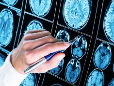 Parkinsonovu chorobu je možné léčit. Musíme ale zjistit, jak lék dopravit do mozku