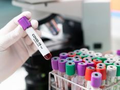 Vídeňští vědci vynalezli jednoduchý test na koronavirus. Ten pozitivní je světle modrý