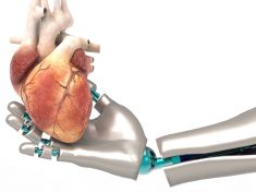 Mají se doktoři bát o práci? Robotičtí chirurgové se blíží