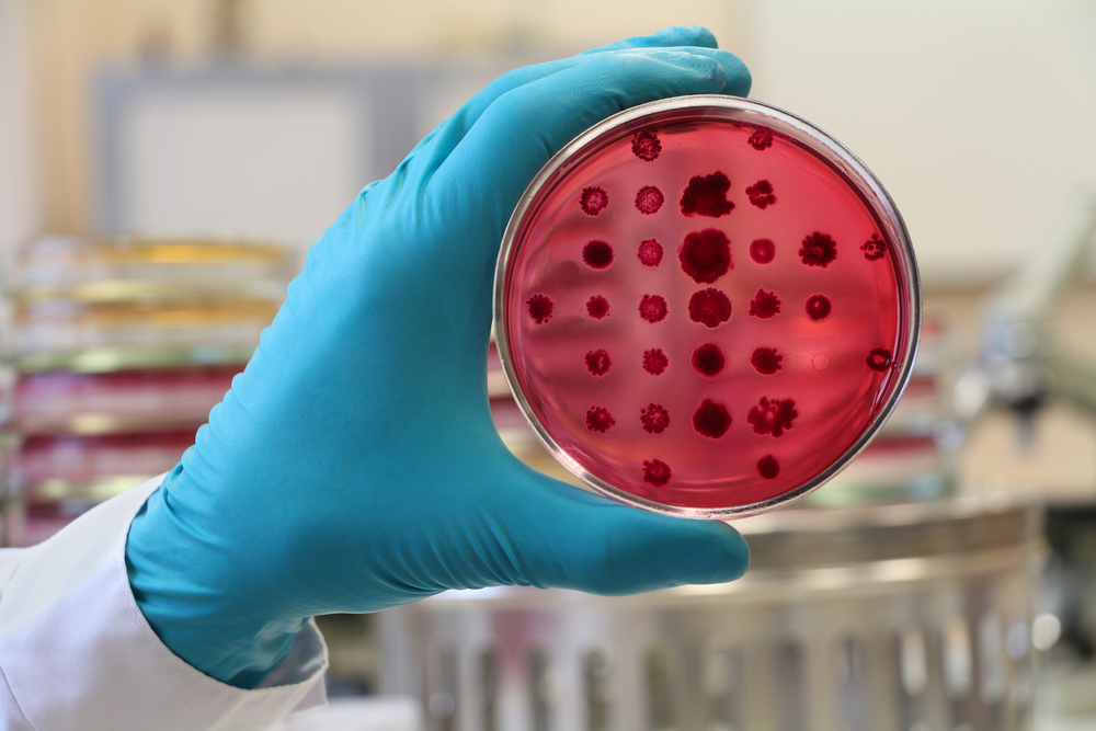 e.coli shutterstock 582221833